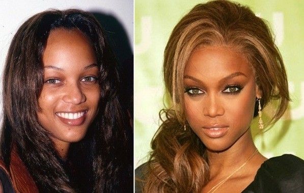 Tyra Banks before and after nose job